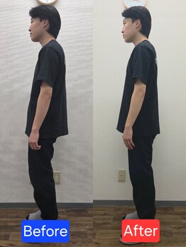 最後の整体 練馬駅前院/腰痛でお悩みの方の姿勢変化
