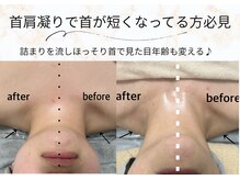 ラン(Ran)/首も実はむくみがち