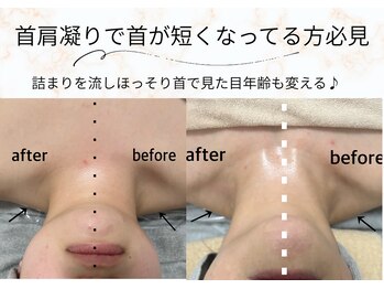 ラン(Ran)/首も実はむくみがち