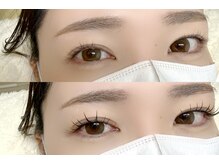 アイビー(eyebee)/アンドヘルシー