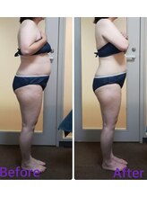 ダイエット サポート(DIET SUPPORT)/3ヶ月コース施術結果