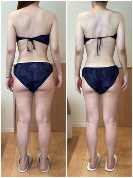 サロンドルフレ(salon de Reflet)の写真/【30代40代】太もも・ヒップ・むくみを全身から整え、すっきり軽やかな下半身へ