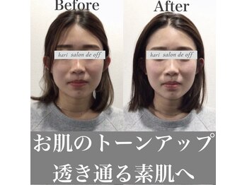 ハリサロンドオフ 心斎橋店(hari salon de off)/お肌のトーンアップ効果あり
