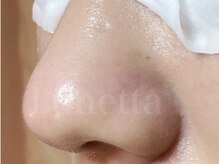 ルネッタ(Lunetta)
