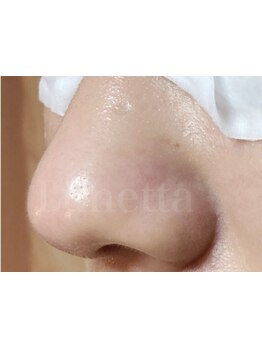 お肌をきれいにしたい