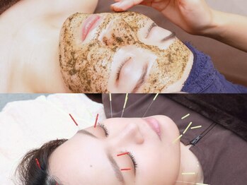ラピス 玉造(Lapis)の写真/【剥離なしハーブピーリング/美容鍼灸】肌質改善ならラピス玉造へ♪溜まった肌内部の老廃物の排出を促進◎