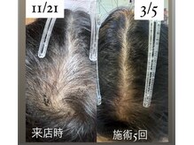 ソラーレ(Solare)の雰囲気（頭皮のお悩みはプロセルにお任せください。）