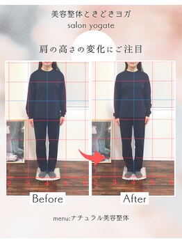 ヨギート(yogate)/リンパ/骨盤矯正/ヘッドスパ小顔