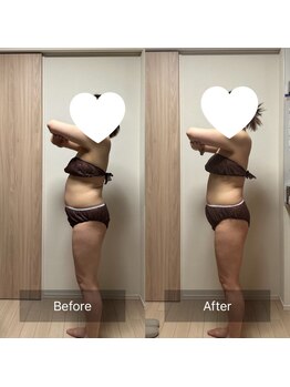 エミナル(EMINAL)/全身リンパケア1回