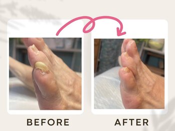 ドクターネイル爪革命 恵庭店/