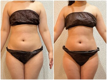 美容整体ウェリナ 中川八田院/小顔矯正/骨盤矯正/美脚サロン