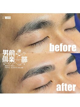男前倶楽部/脱毛/メンズ脱毛/メンズ専門店