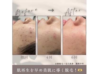 モアトゥインクル 福山宮通り店(MORE twinkle)の写真