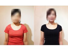 松山美容整体院/（30歳代）施術例