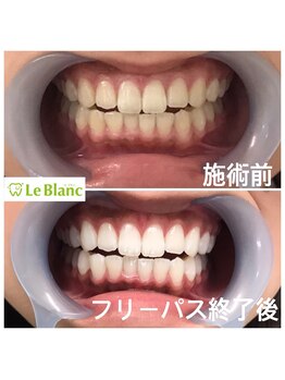 ルブラン 奈良店(Le Blanc)/夢に向かって!!