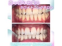 ライトビューティー 池袋店(LightBeauty)/症例写真