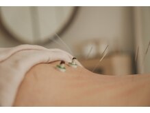 ハリムーン 仙台(harimoon)/身体鍼灸