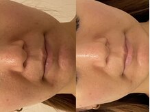 ラヴィエ ベル(La vie est belle)/ルヴィハーブ陶肌トリートメント