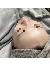 フットミー(foot mii)/韓国最新美容