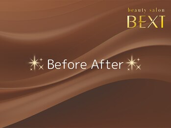 ベクスト(BEXT)/【Before After】