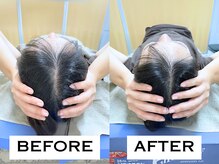 ビハリスト 新宿マルイ本館/頭のサイズからしっかり小顔に♪