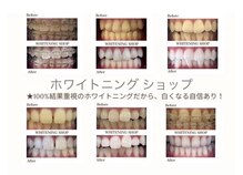 ホワイトニングショップ 所沢店
