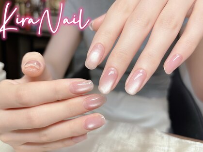 キラネイル(Kira Nail)の写真