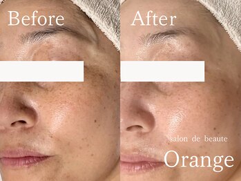 サロンドボーテ オランジュ(salon de beaute Orange)/ハーブ&ホームケア