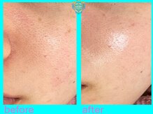 リュクス(LUXE)/ビフォーアフター