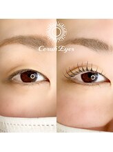 チュラアイズ(CerahEyes)/【お客様ビフォーアフター】