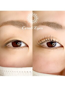 チュラアイズ(CerahEyes)/【お客様ビフォーアフター】