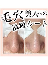 ルネッタ(Lunetta)/