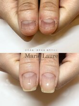 マリーロール 淀屋橋本店(Marie Laure)/自爪育成/深爪矯正/ネイルケア