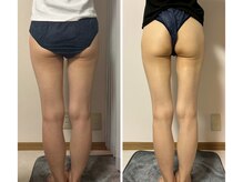 ルナグランデ 心斎橋店(Luna grande.)/太もも隙間作りはお任せください