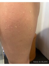 サロン ド ブラン アオヤマ(Salon de BLANC AOYAMA)/