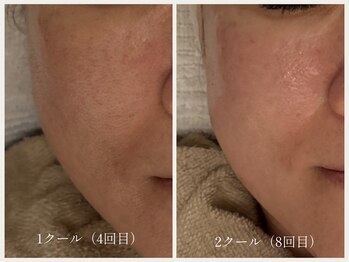 グランボヌール(grand bonheur)/【バクテリウムピール】