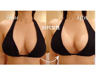 サロンハナ(Salon HANA)/30代女性のビフォーアフター