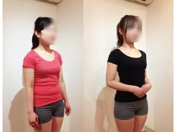 松山美容整体院/（30歳代）施術例