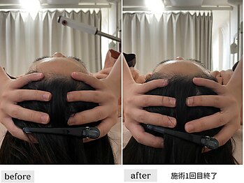 ペルク(perk)/小顔コルギ70分