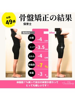 セレンディピティ 刈谷店(Serendipity)/【美容骨盤矯正】痩身ダイエット
