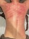 エクラ(eclat)の写真/【高リピート率】メリハリのあるくびれを手に入れたい方必見!!短期集中でサイズダウン◎