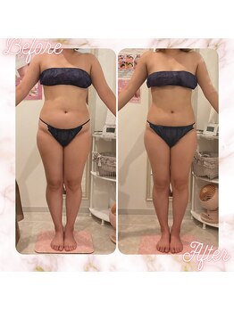 リムサロン(RIMSALON)/