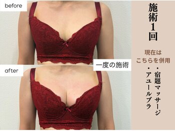 ソワ(soie)/産後でも目指せる美人バスト