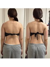 きらくる/背中～ウエストの変化