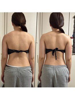 きらくる/背中～ウエストの変化