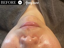 アングレイス(Anngrace)/
