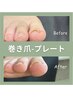 《プレート》【巻き爪矯正2本】透明で目立たず即効性も期待★2本¥11500