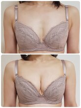 美人バスト リグラス(ReGrous)/バストアップbefore,after