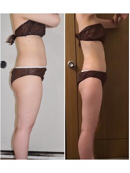 ビューティーワークスシャンティ 柏店(Beauty Works Shanti)/ー11kg！！達成！！