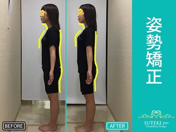 美骨矯正 ステキプロ(SUTEKI pro)/ストレートネック・巻肩・肩こり
